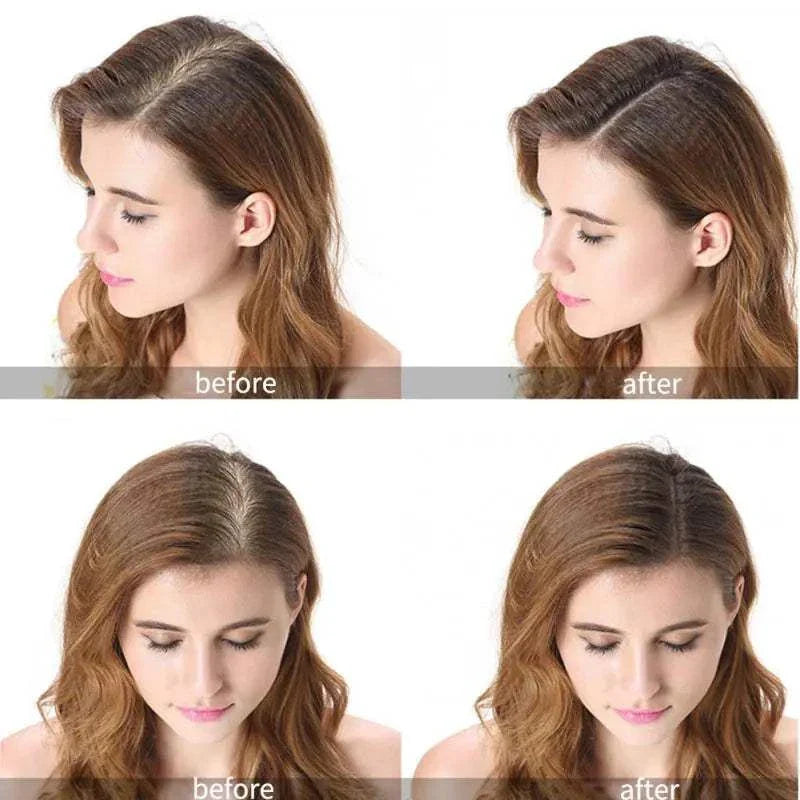 ginger hair growth