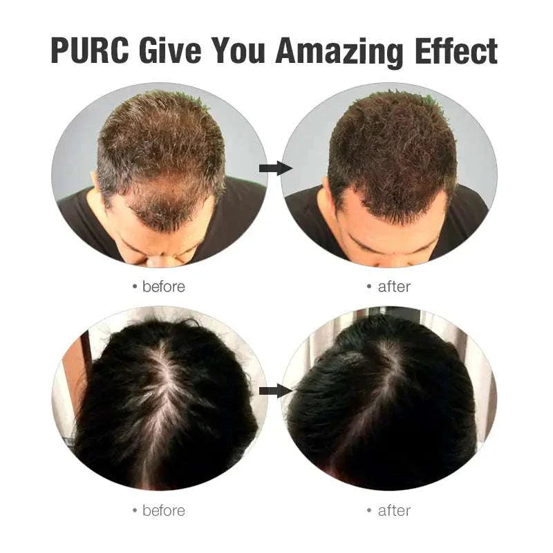 ginger hair growth
