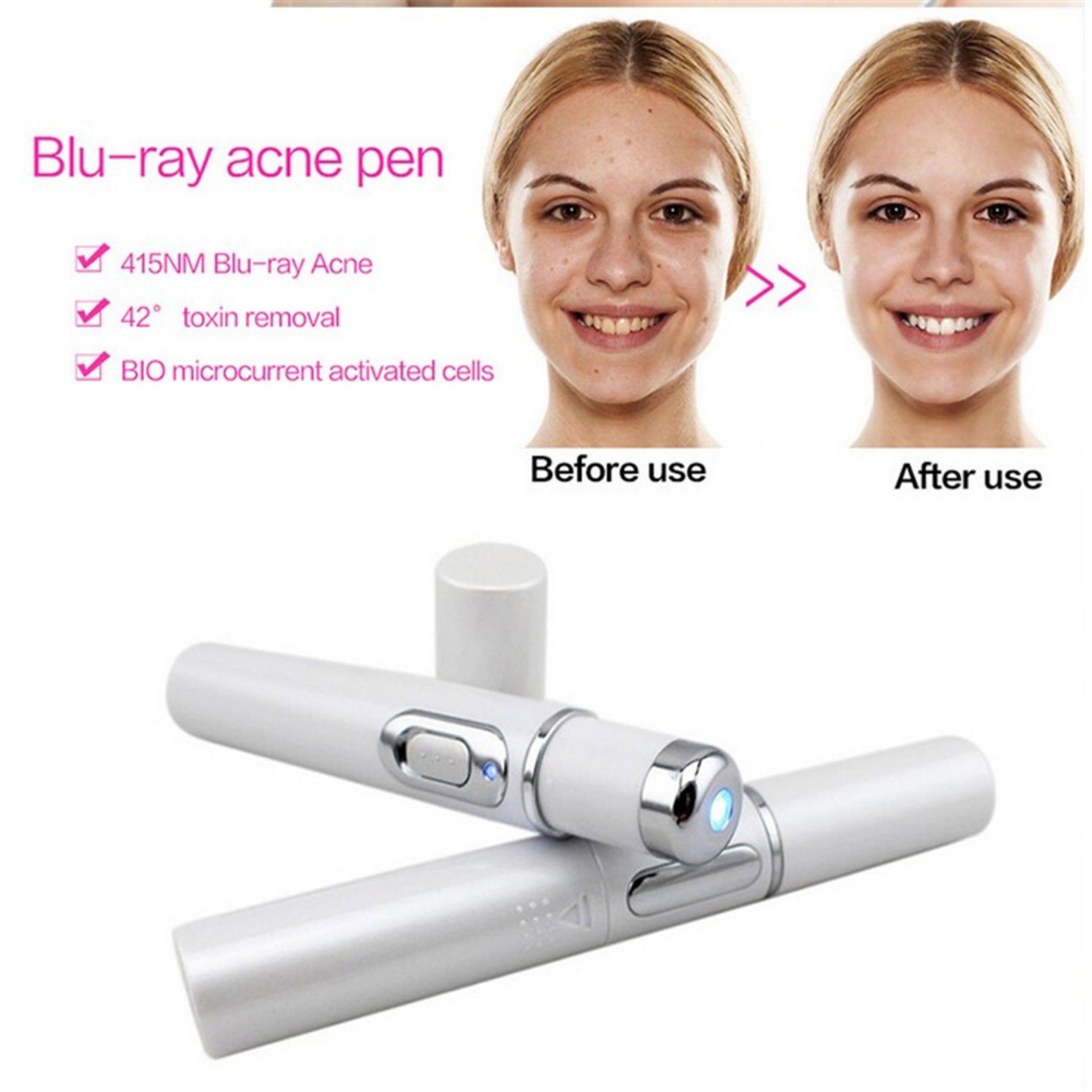 Blue Light Therapy Acne Laser Pen – Soft Scar & Wrinkle Remover
