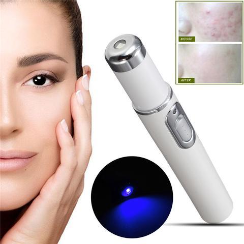 Blue Light Therapy Acne Laser Pen – Soft Scar & Wrinkle Remover