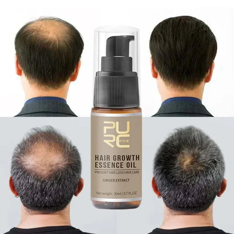 HAIR GROWTH
